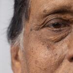 Como reconhecer Alzheimer observando os olhos